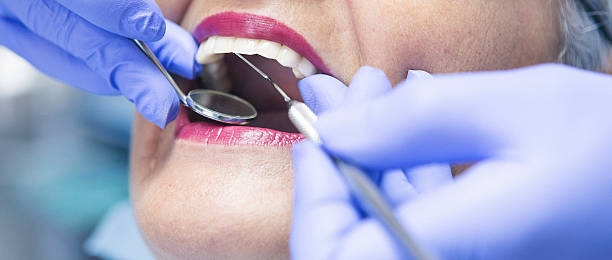 Best Emergency Treatment for Dental Infections or Abscesses in Saybrook Manor, CT